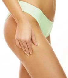 cellulite