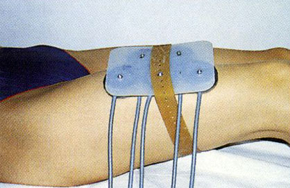 ultrasuoni
